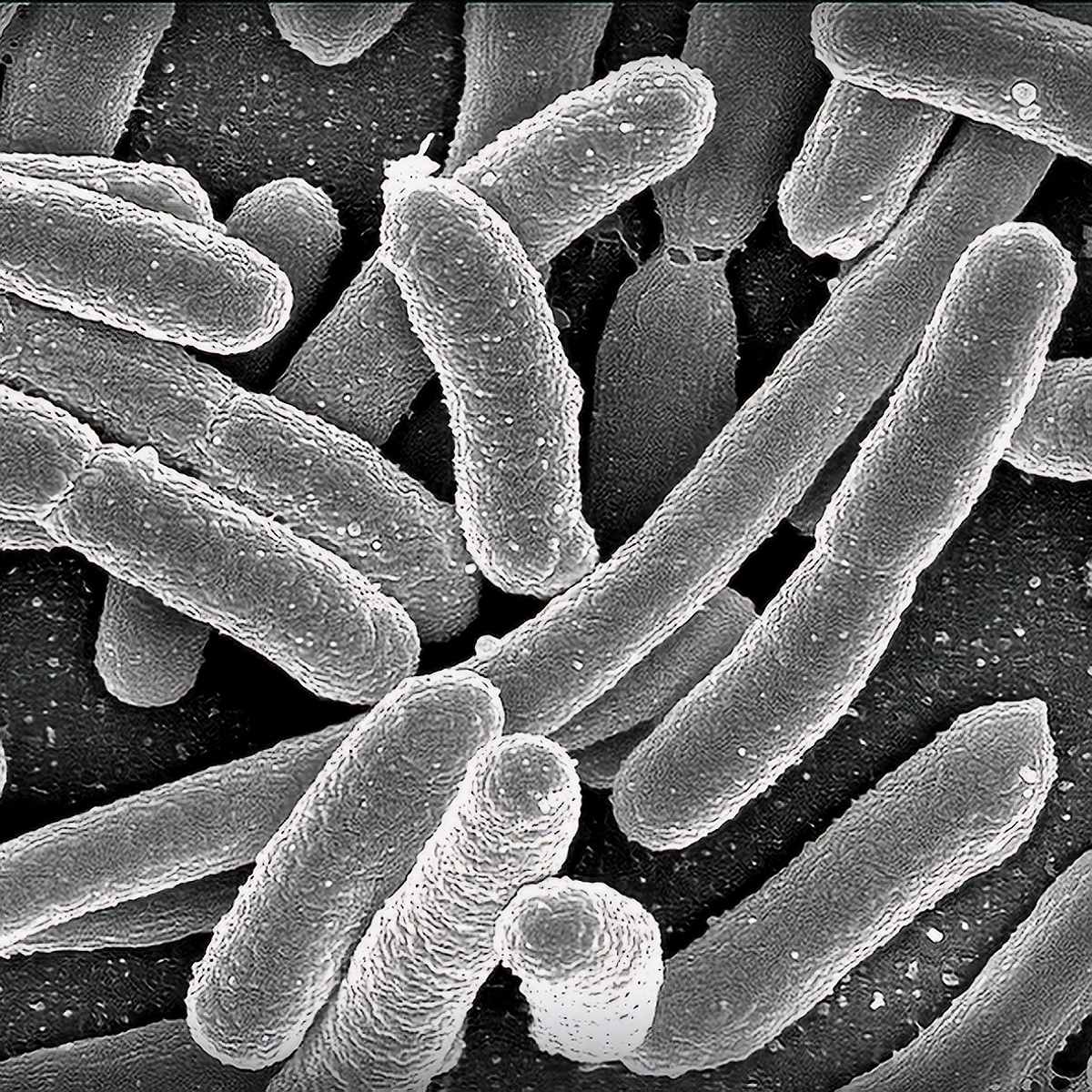 Bactérias E. coli