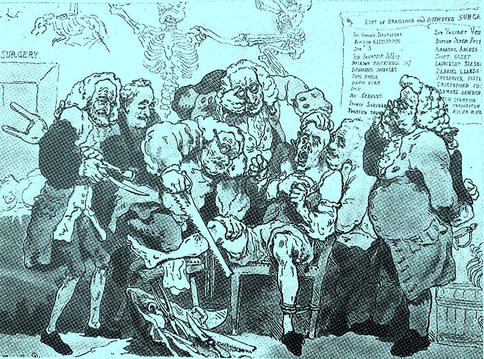 amputação, século 18