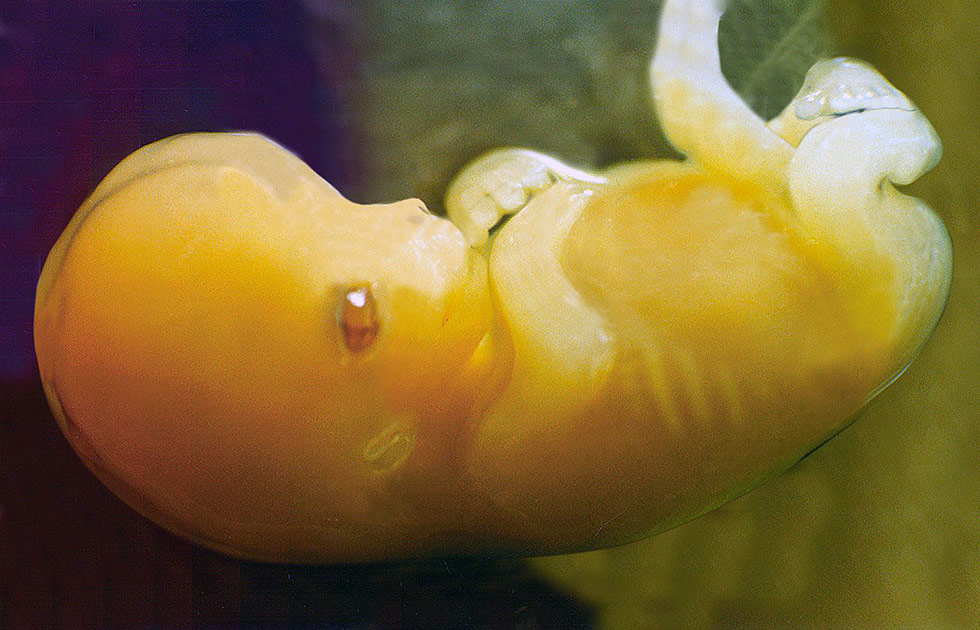 Embrião humano, sete semanas após a concepção